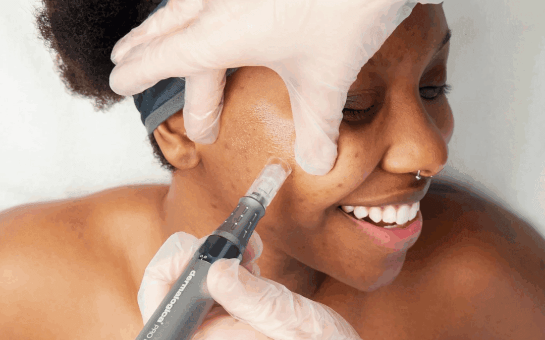 ‘Sharp Standards’ A Guide to Elevate Microneedling Safety is launched by BABTAC and Dermalogica
